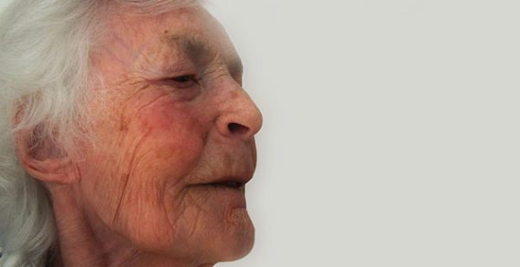 Some promising treatments for Alzheimer’s Some promising treatments for Alzheimer’s