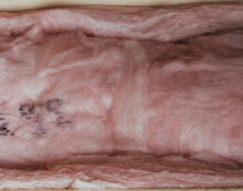 Installing insulation can be hazardous to your health Installing insulation can be hazardous to your health