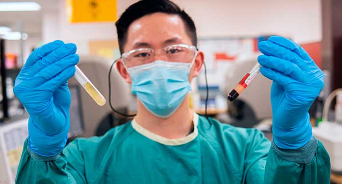 Lab technologist New lab-developed procedure improves treatment for fire victims
