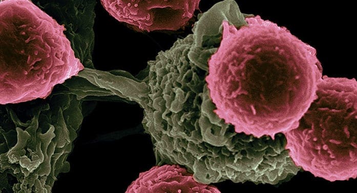 cancer cells Marker may predict response to cancer immunotherapy